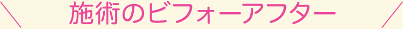 施術のビフォーアフター